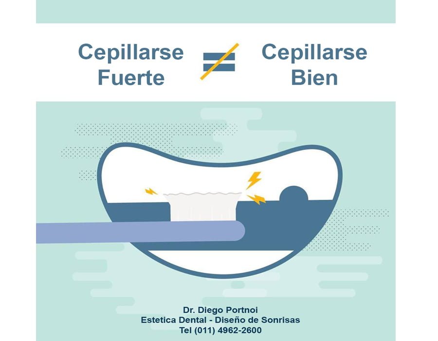 Como mantener tus dientes limpios