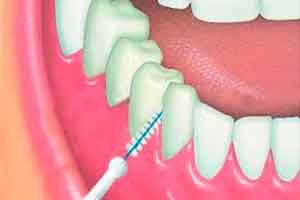 Como cuidarse ENTRE los dientes